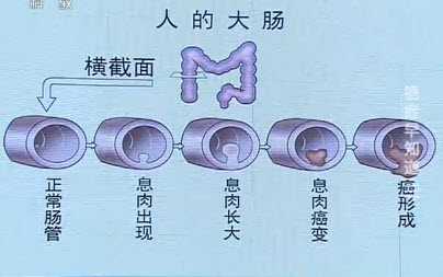 人的大肠图片